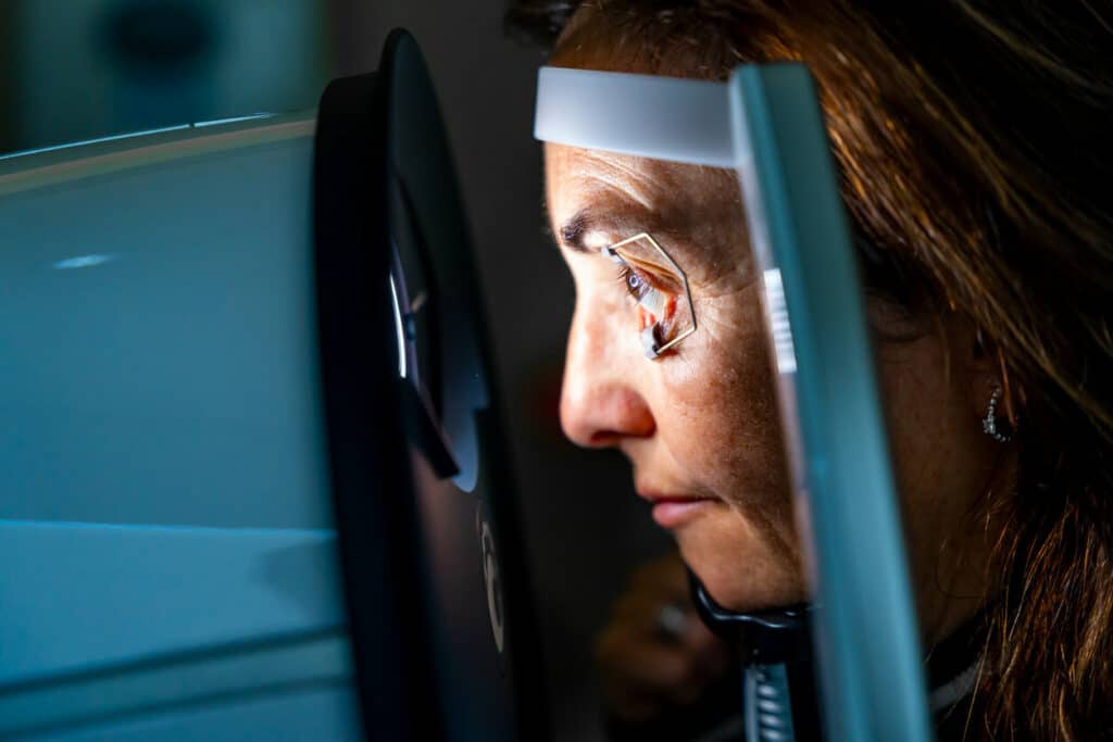 A woman with eye opener during a laser eye treatment for glaucoma.