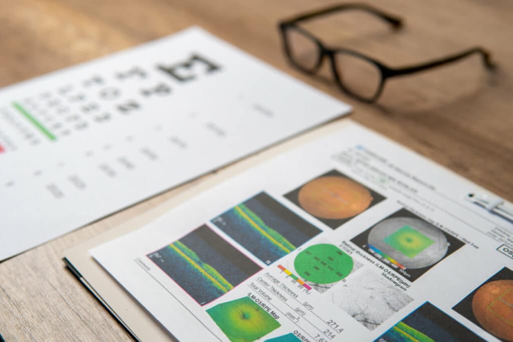 A pair of eyeglasses and a macular report including eye charts and OCT scans.