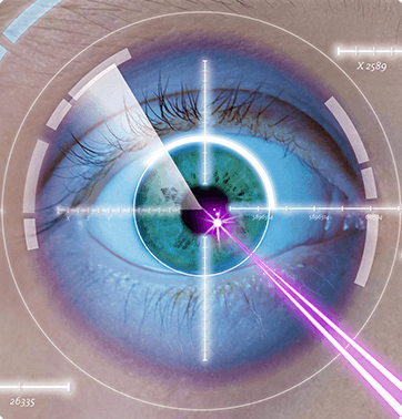 LASIK - Refractive Surgery - Advanced Sight Center - myopia - nearsightedness - astigmatism