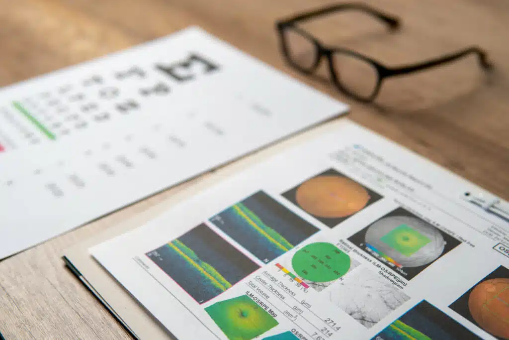 A pair of eyeglasses and a macular report including eye charts and OCT scans.