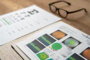 A pair of eyeglasses and a macular report including eye charts and OCT scans.
